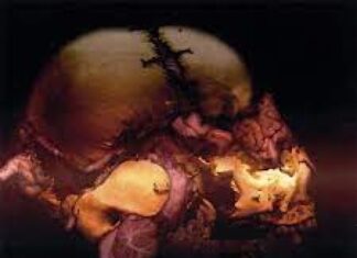 Album: Machinations of Dementia by Blotted Science